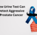 New Urine Test Can Detect Aggressive Prostate Cancer