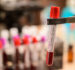 Kerala to Launch Real-Time Blood Bank Tracking App – A Big Step Towards Safer, Smarter Blood Donation