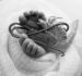 Kolkata Infant Undergoes Rare Off-Pump Heart Surgery — A Medical Milestone in Pediatric Cardiac Care