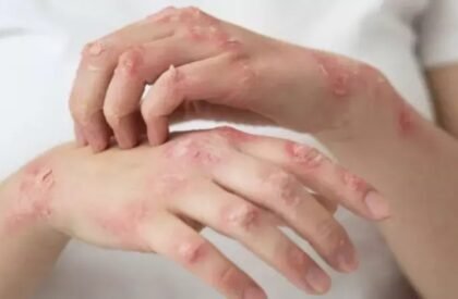 WhatsApp Image 2026-03-24 at 4.04.12 PM